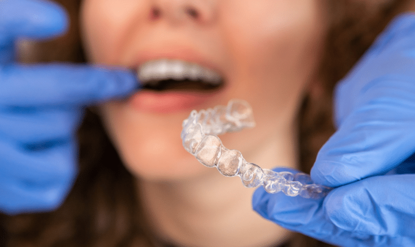 What to Expect at Your First Invisalign Consultation